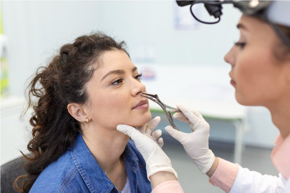 Best rhinoplasty surgery in bangalore 